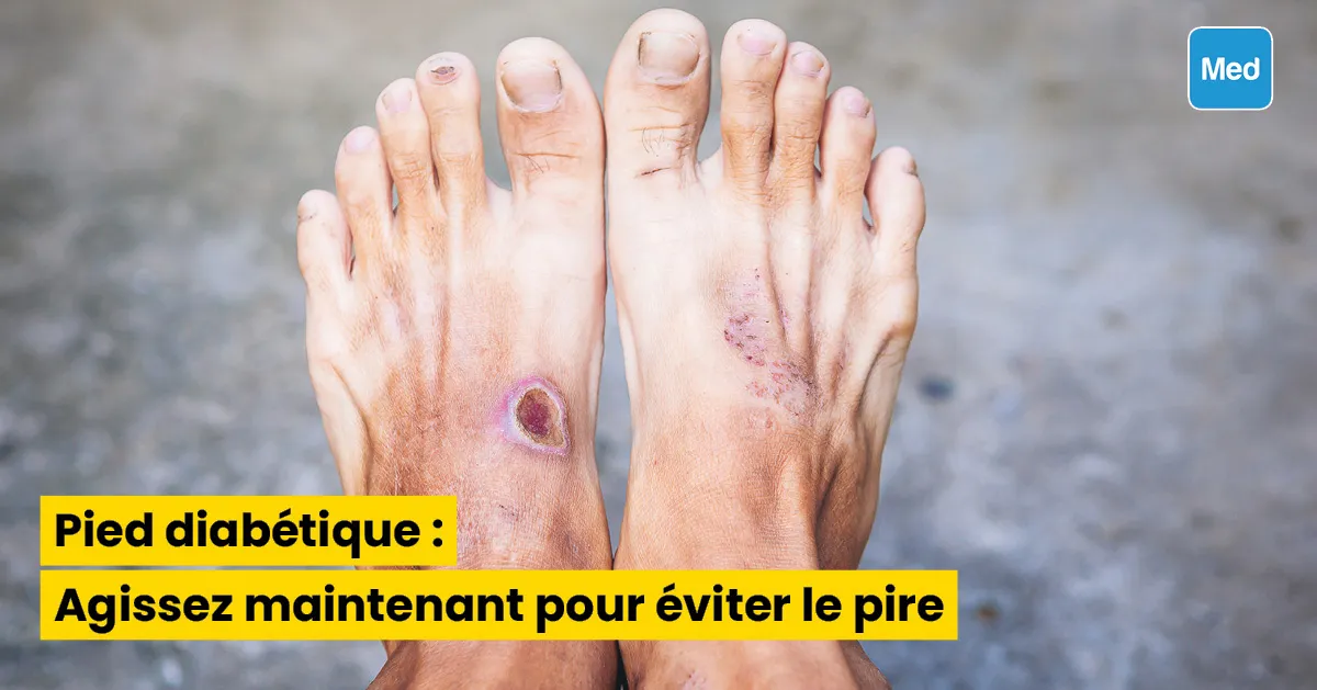 Pied diabétique : Agissez maintenant pour éviter le pire